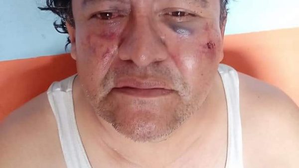Extorsionan y golpean en Cuautitlán Izcalli a Chofer de tráiler